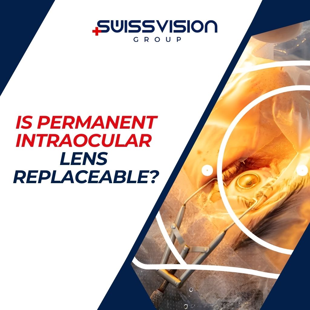 Is Permanent Intraocular Lens Replaceable